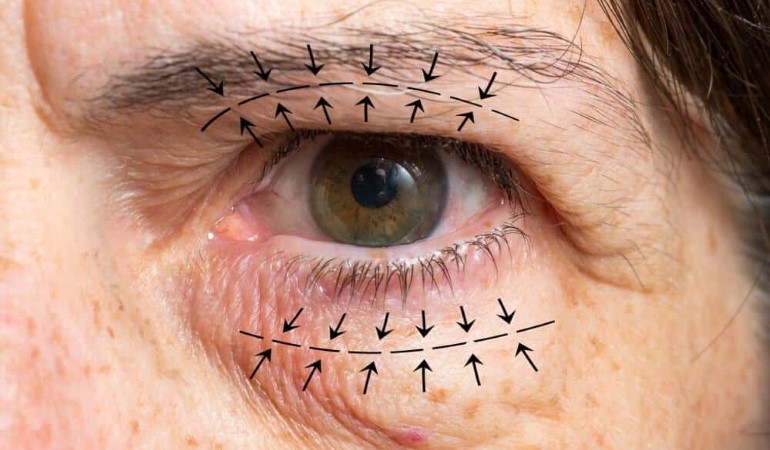 Oculoplastic & Reconstruction Surgery